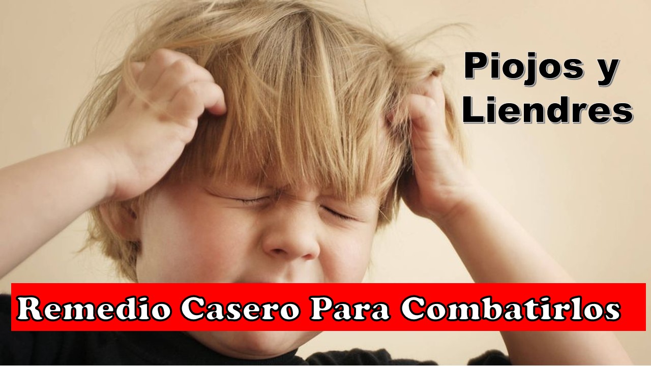 Remedio Casero y Natural para Combatir Piojos y Liendres