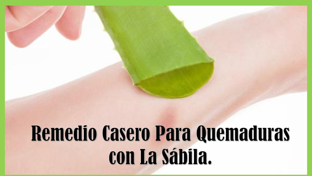 Remedio Casero Quemaduras en la Piel con Sabila